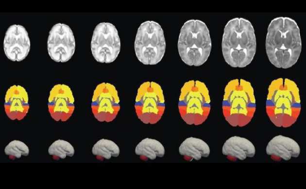 Brain scans