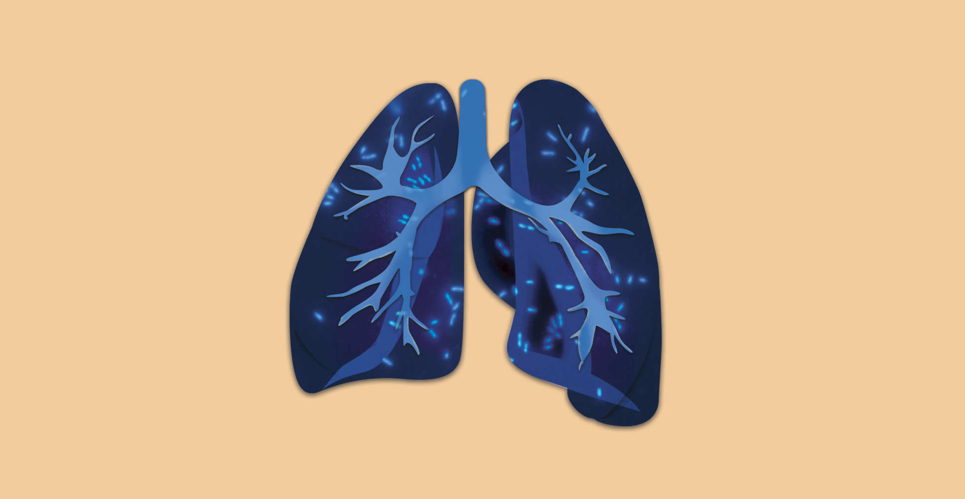 Illustration of detail of a lung overlaid with images featuring P. aeruginosa PAO1