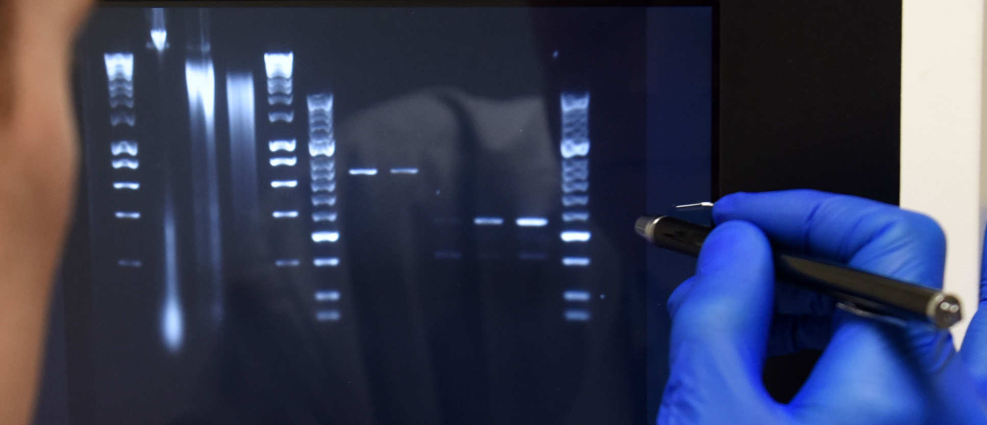 Analysis of gel image