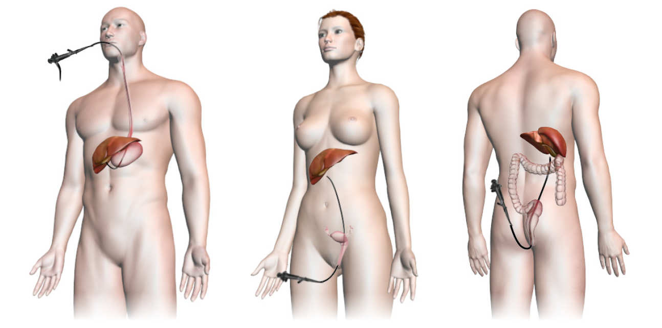 Diagram showing how endoscope passes into the human body through mouth, vagina or rectum