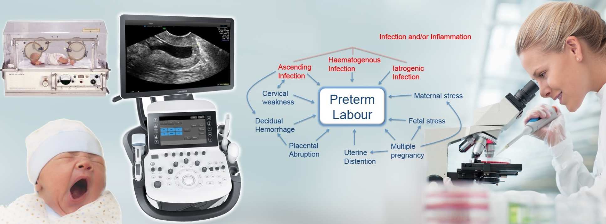 Preterm labour graphic