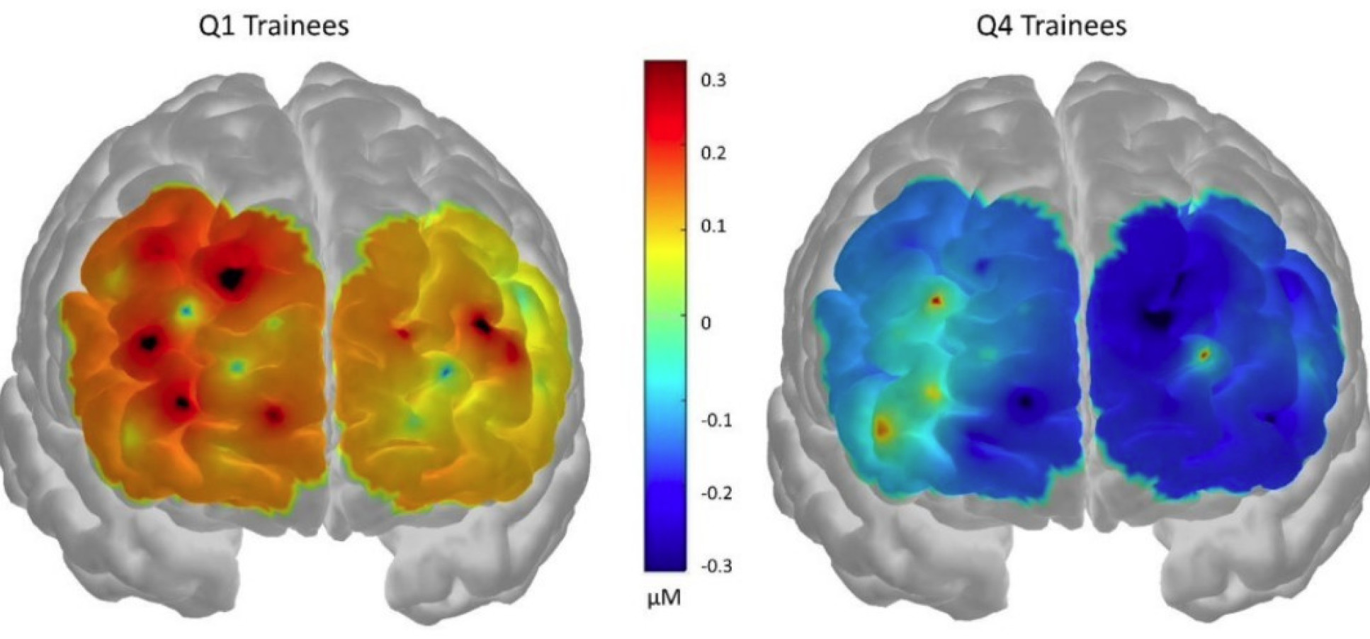 Brain Sacns