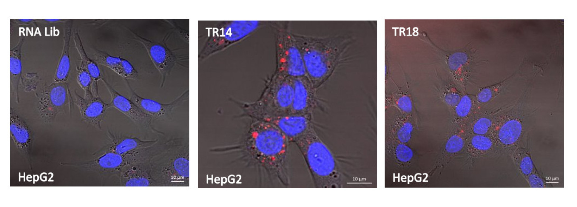 Transferrin Aptamer (TfR) aggregates at the receptors on the surface of cancer cells​