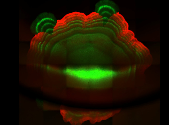 Synthetic pattern formation in a bacterial colony. Credit: Tong Zhu.