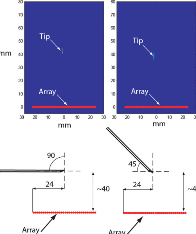 Improving the visibility of biopsy needles under ultrasound guidance