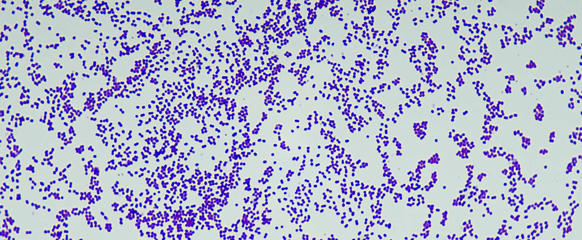 Membrane antigens workstream