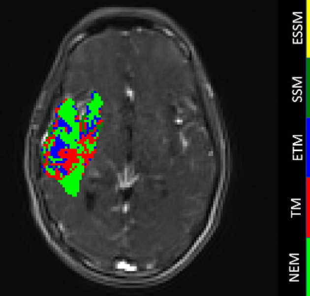 DCE MRI data modelling