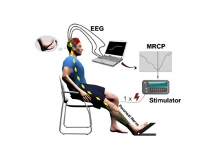 NeuroModulation