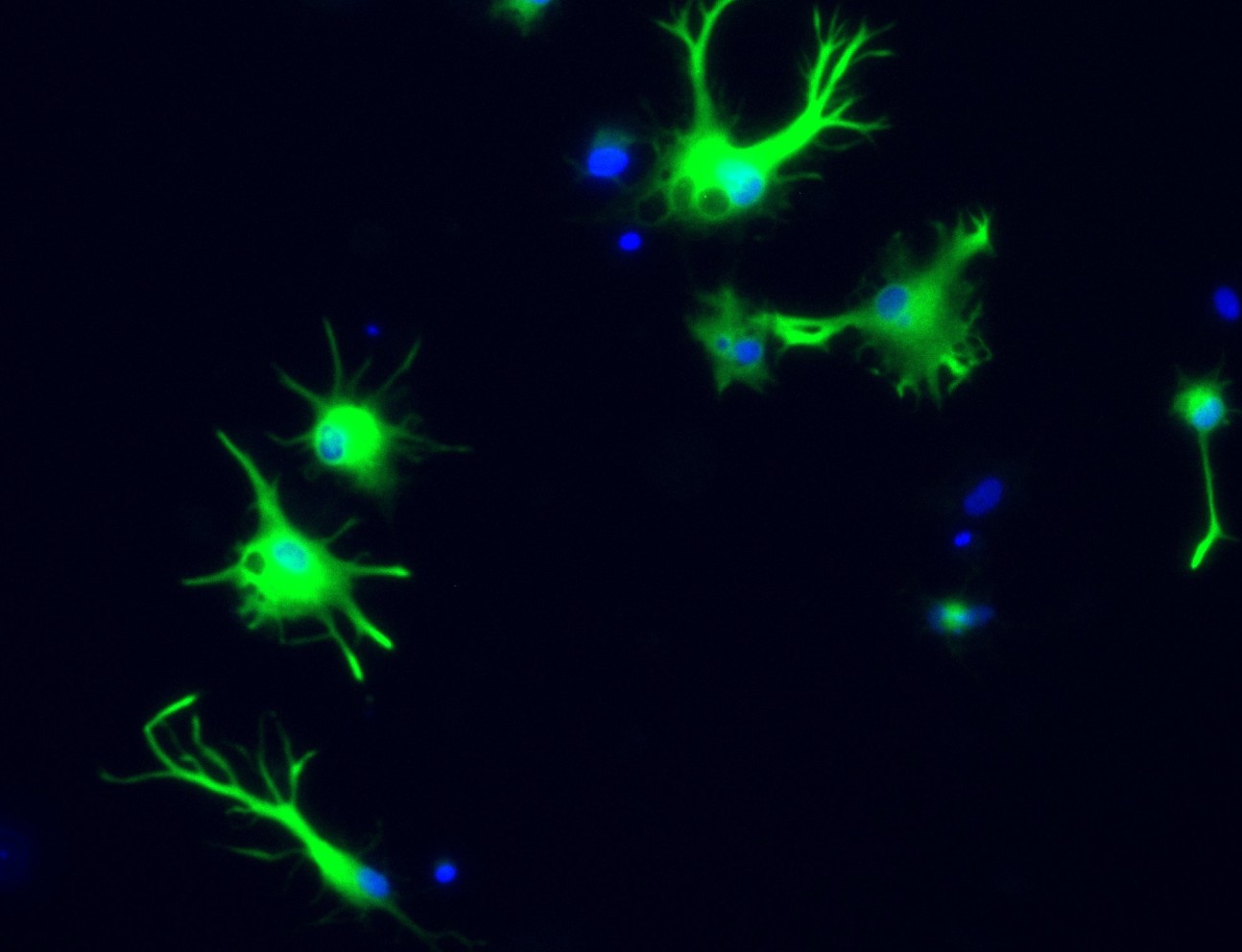 fluorescent image of astrocytes