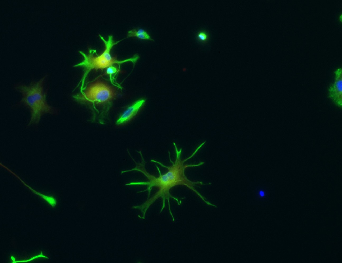 fluorescent image of astrocytes