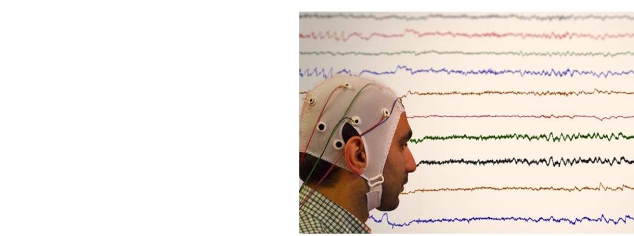 EEG Cap