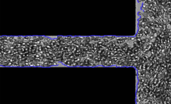 Red blood cells passing through a T-junction (Dr Joseph Sherwood) 