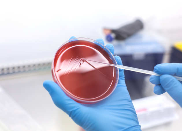 Sample image: A scientist holding a petri dish and inoculating a blood agar plate in the Biological Safety Cabinet